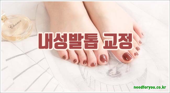 내성발톱 관련이미지이미지입니다.