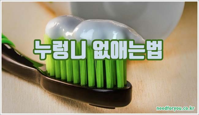 누렁니 관련이미지이미지입니다.
