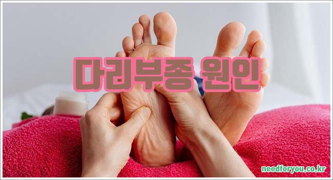 다리부종 관련이미지이미지입니다.
