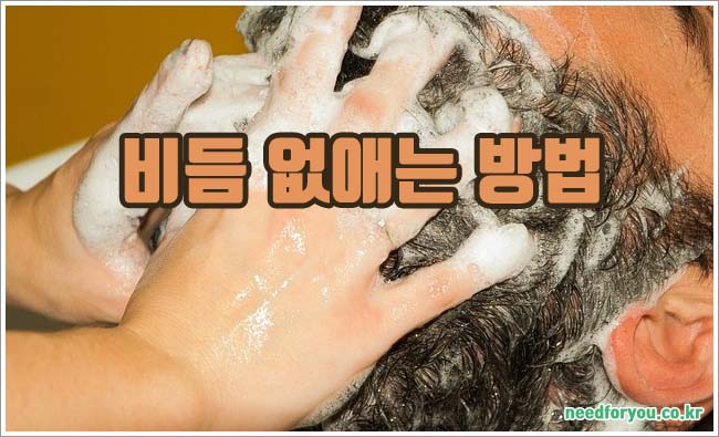 비듬 없애는 관련이미지이미지입니다.